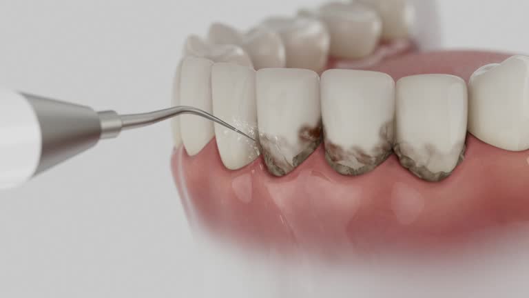 Trusted Root Canal Treatment service in Berkeley Lake, GA - Dentist Open Now